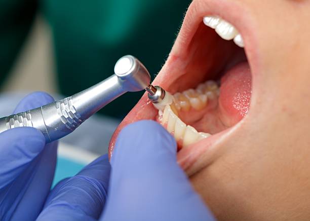 Laser Dentistry in South Haven, MI